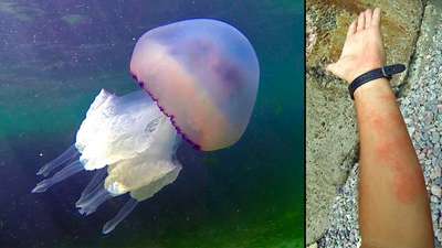 Какие медузы водятся в Черном море? Жалят ли они людей?